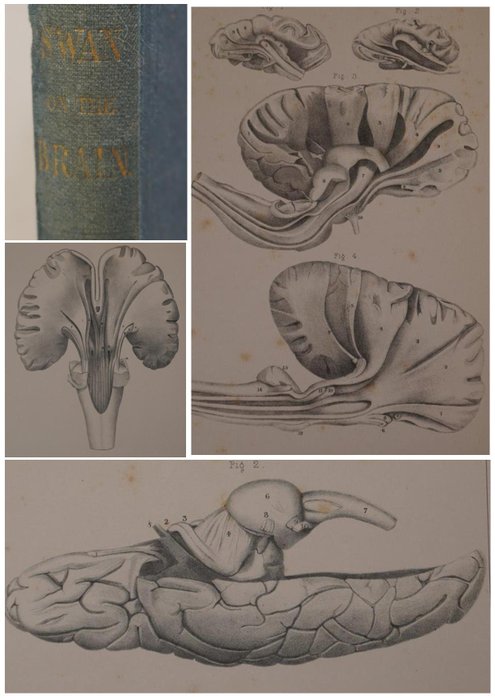 Joseph Swan - Delineations of the brain in relation to voluntary motion - 1864