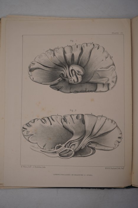 Joseph Swan - Delineations of the brain in relation to voluntary motion - 1864