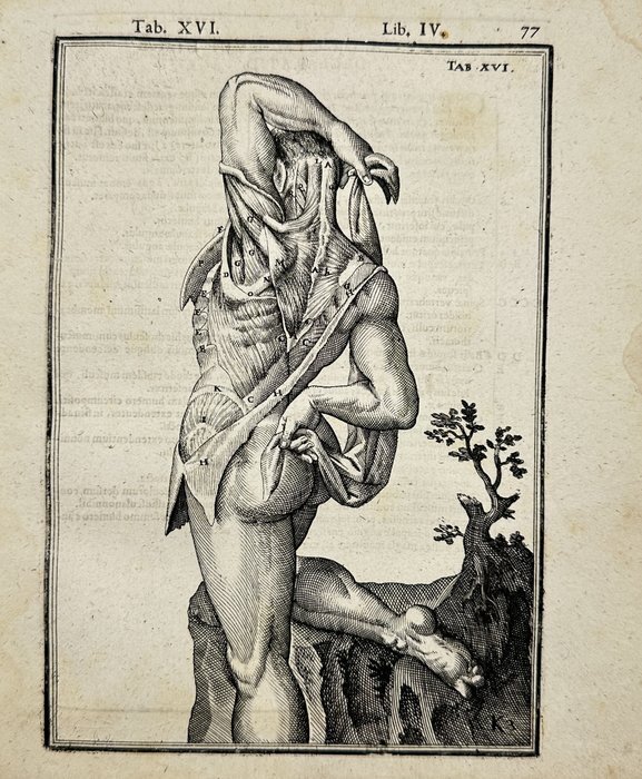 Adriaan van den Spiegel (XVII)  Giulio Casseri - De humani corporis fabrica libri decem - Plate XVI - Male ecorche abdomen exposed