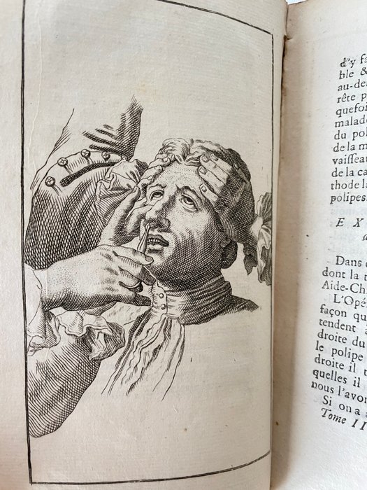 Croissant de Garengeot - Traité des opérations de Chirurgie - 1748