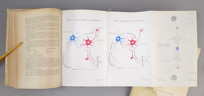 Roger de la Fuÿe - Traité d'acupuncture  Atlas - 1947