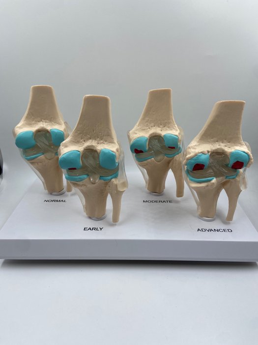 Uddannelses-/demonstrationsmodel - knæsygdom anatomisk model - 1990-2000