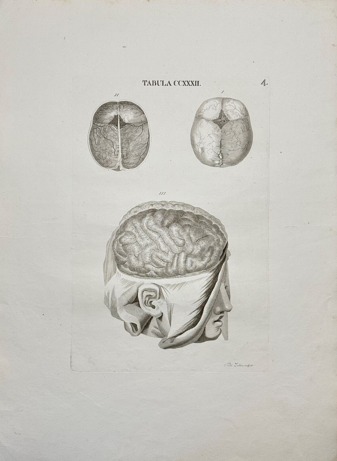 Anatomy Antique Print - Antonio Caldani - Human Brain - 1813 Year - F4