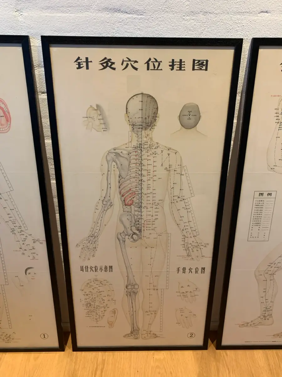 Ukendt Anatomi akupunktur plakater
