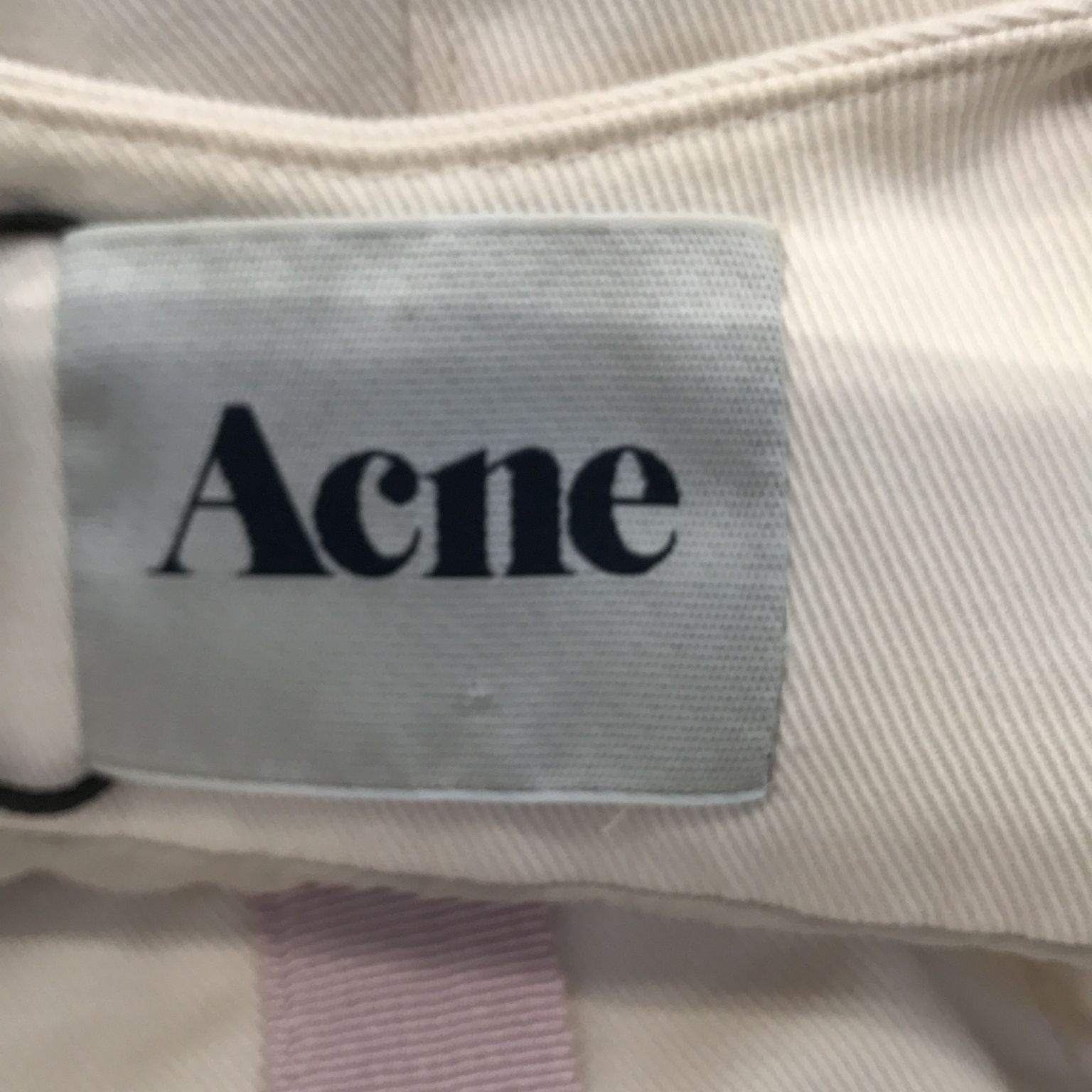 Acne