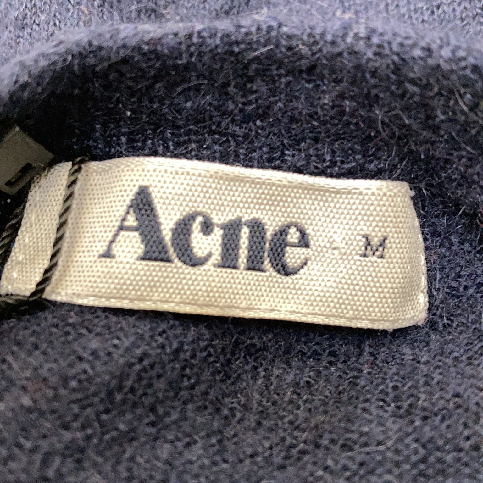 Acne