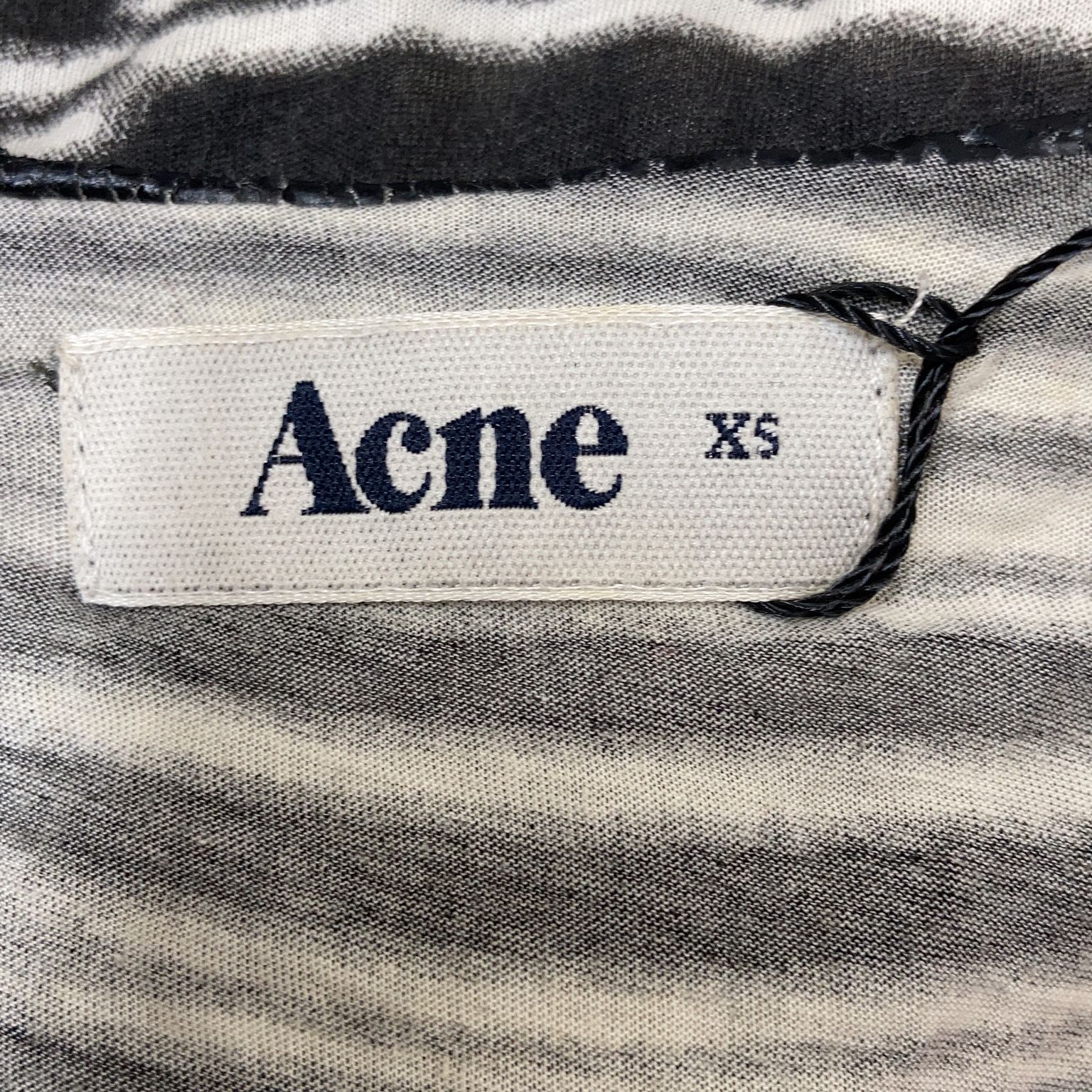 Acne