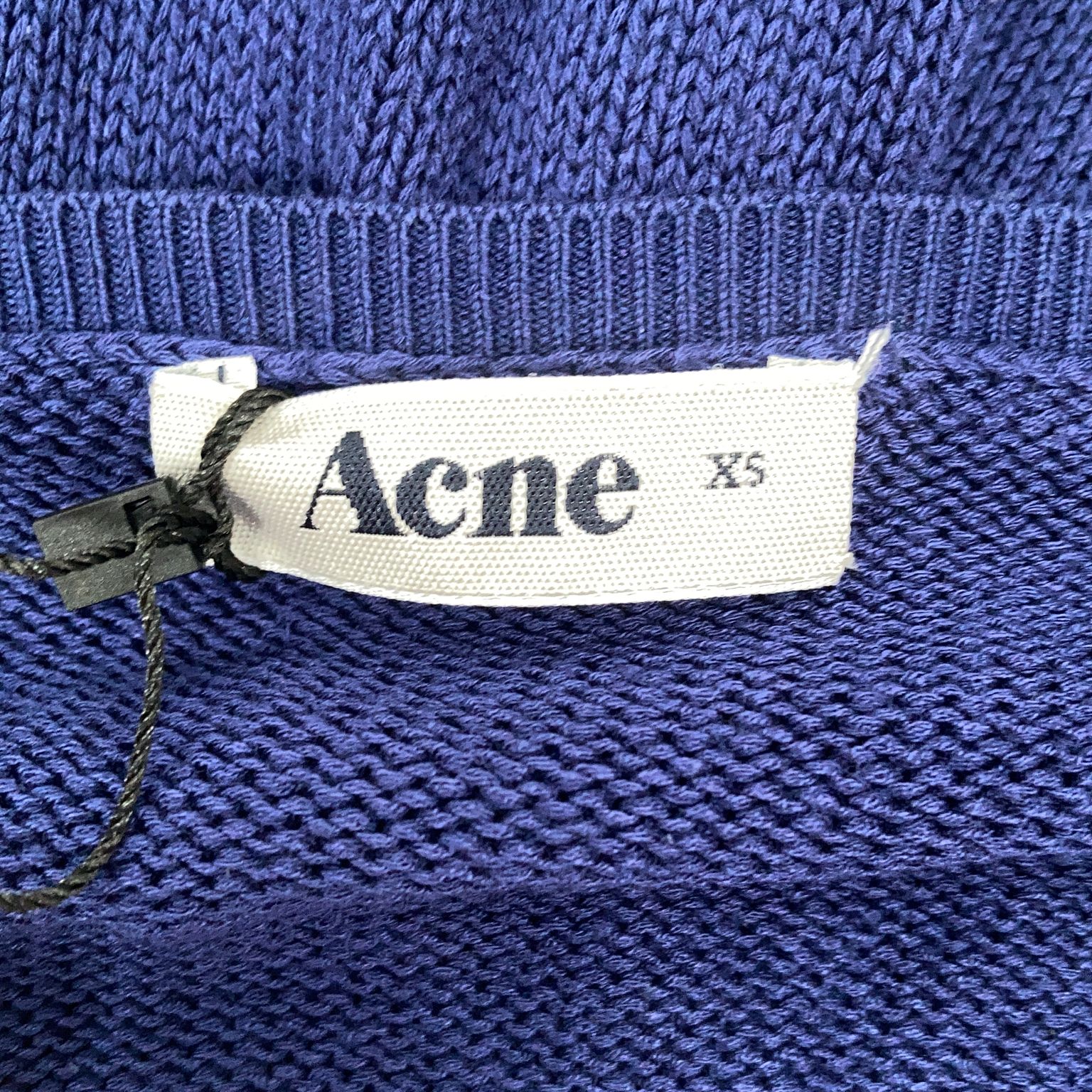 Acne