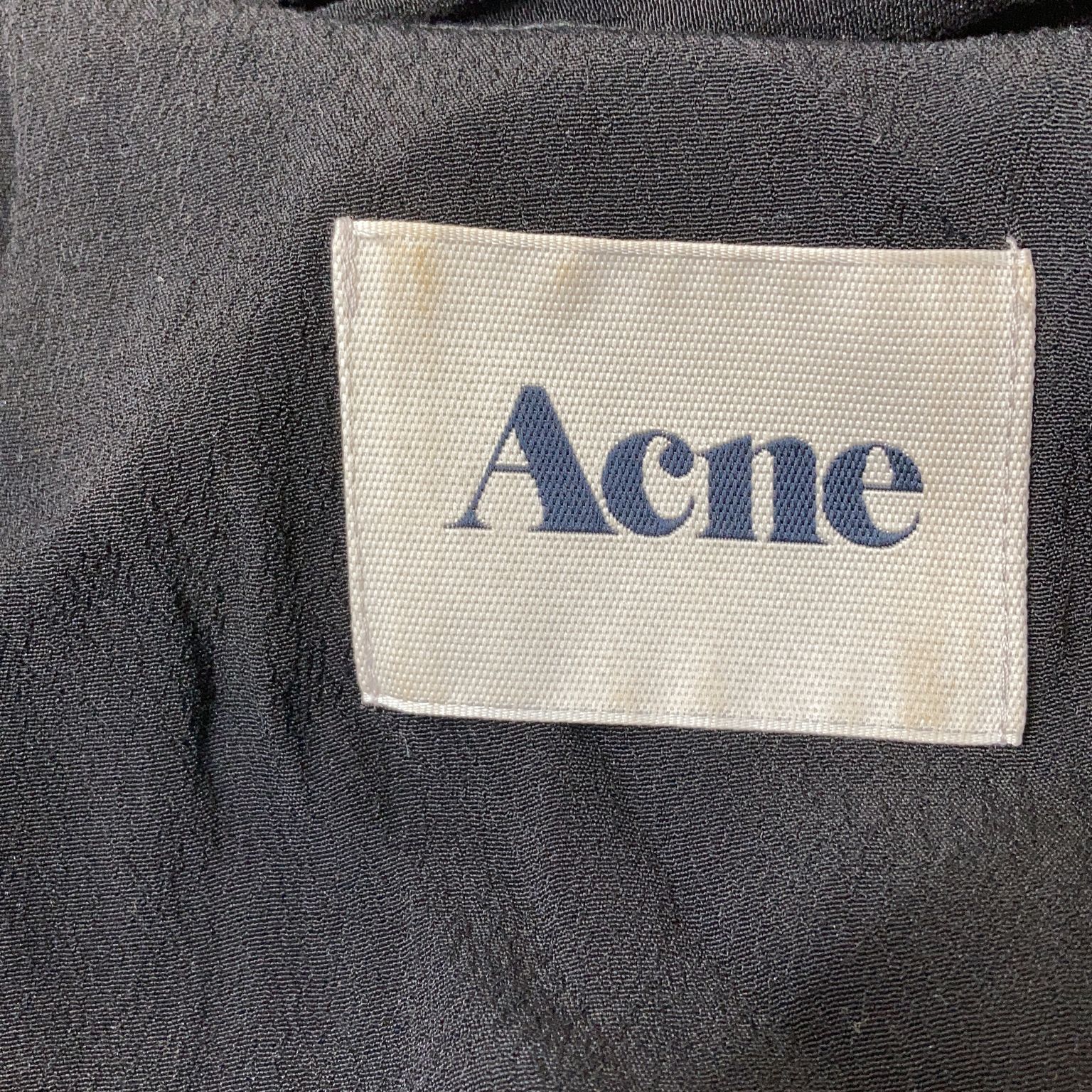 Acne