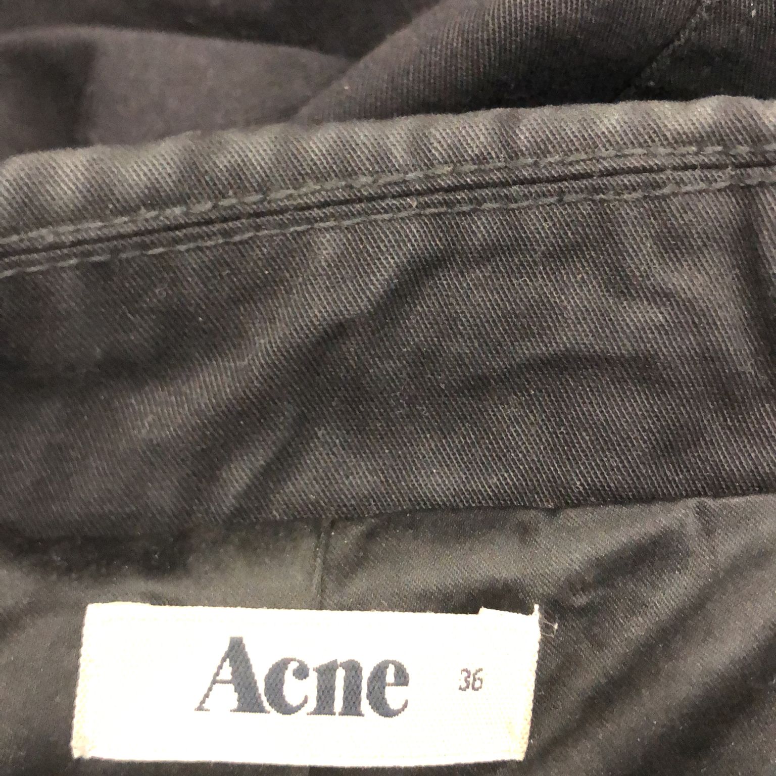 Acne