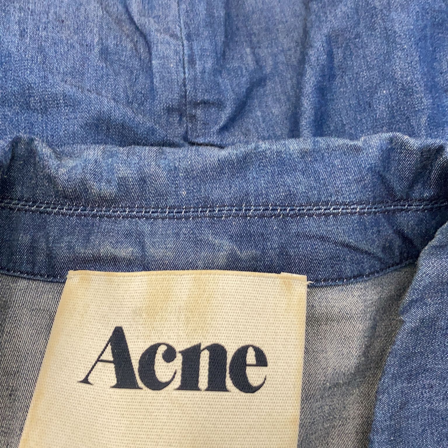 Acne