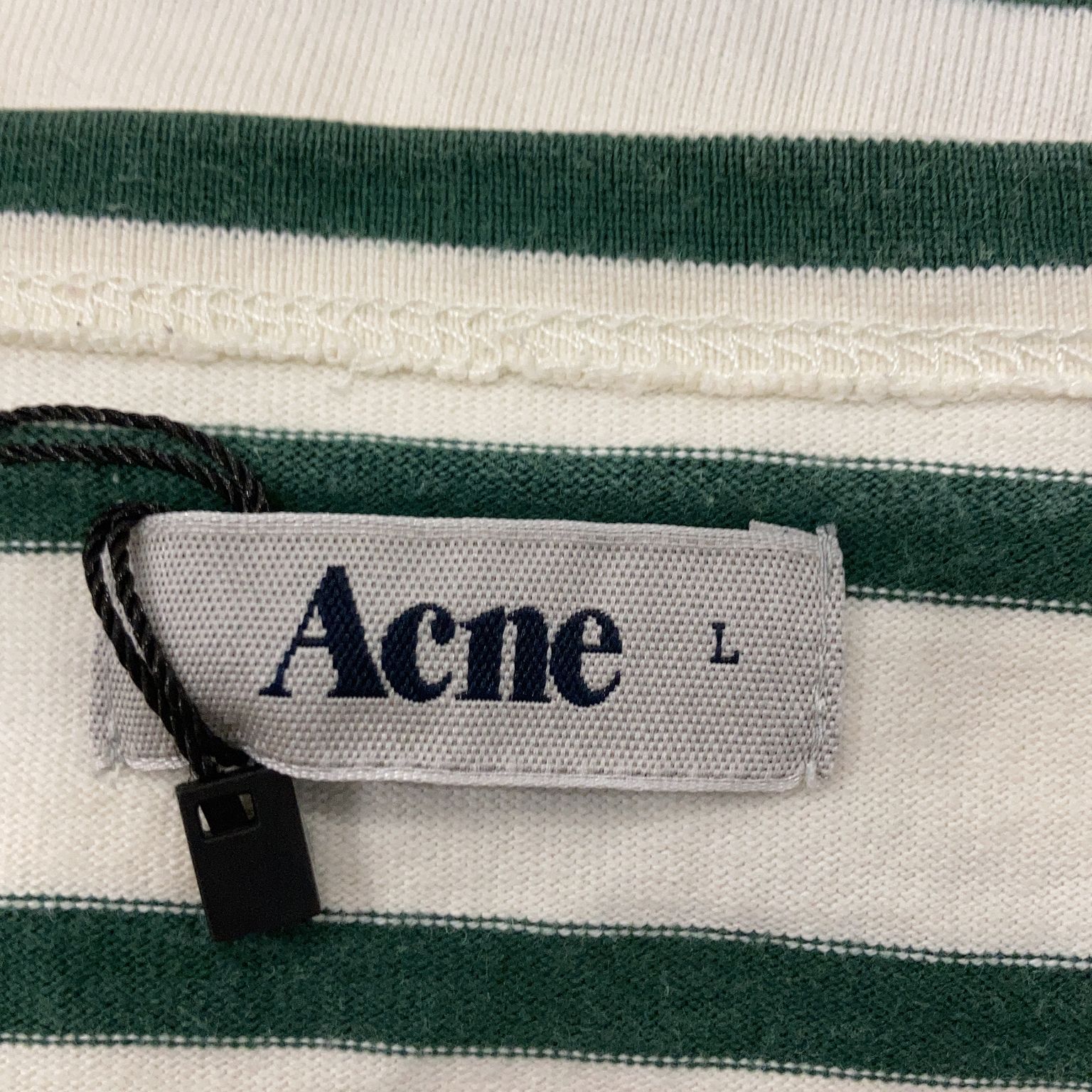 Acne