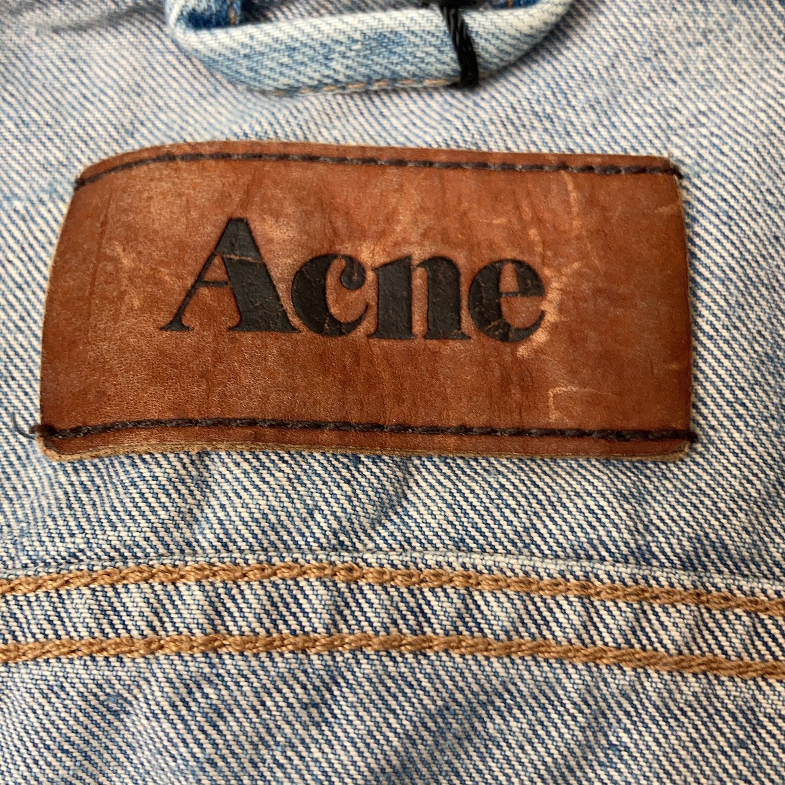 Acne