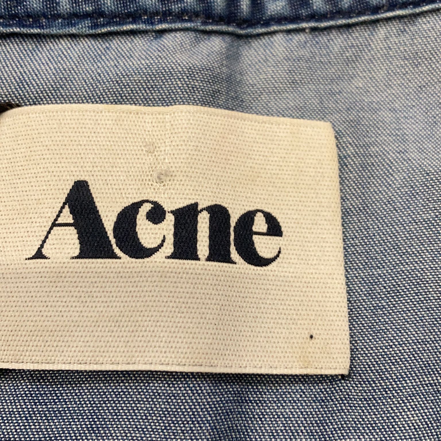 Acne