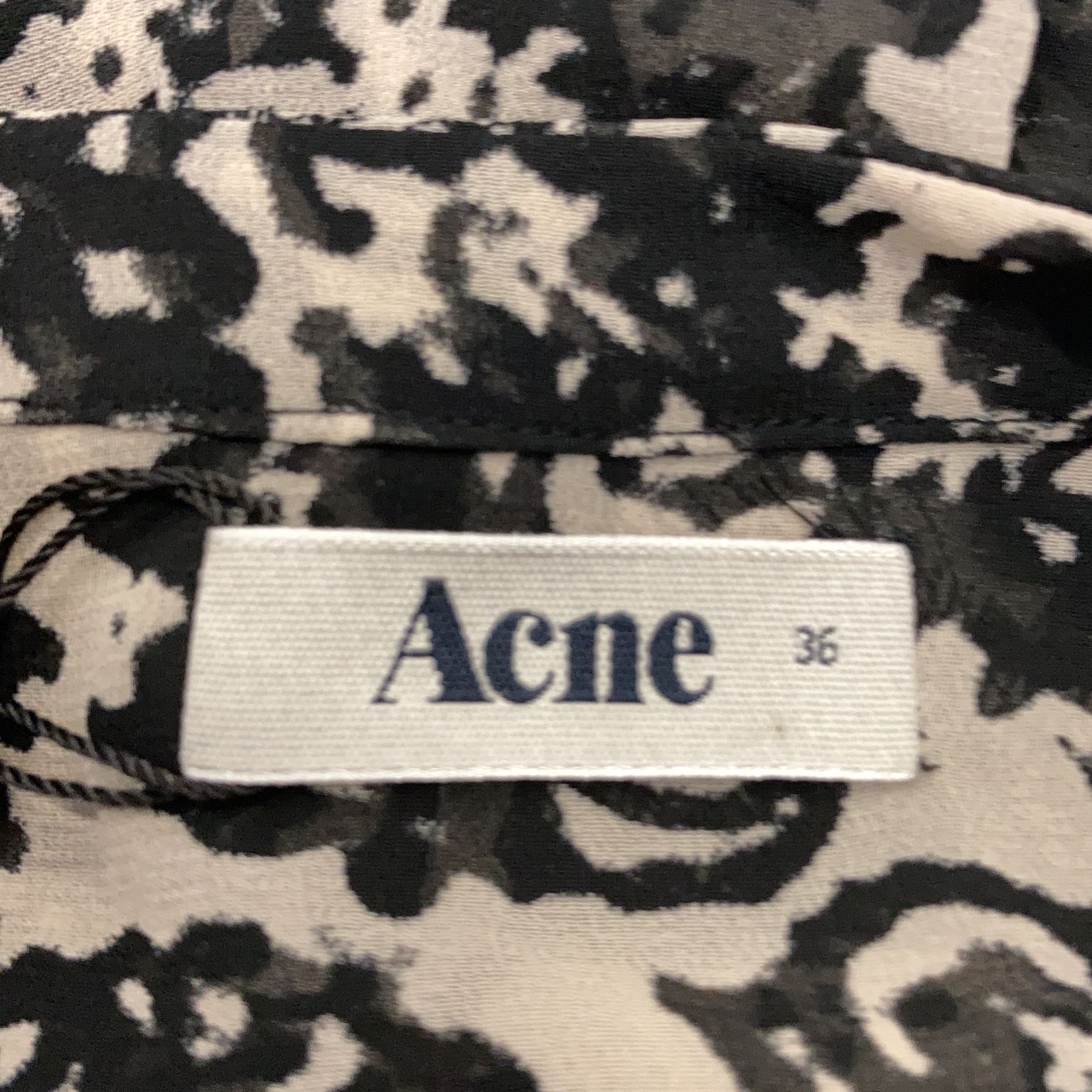 Acne