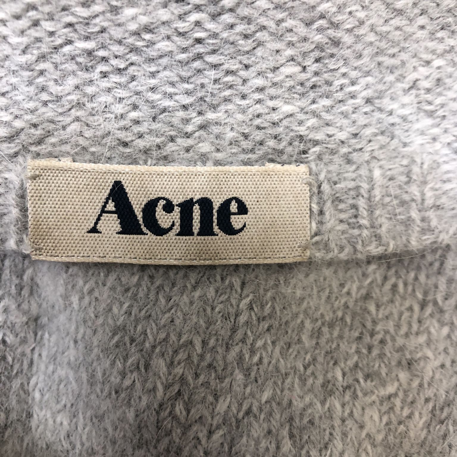 Acne