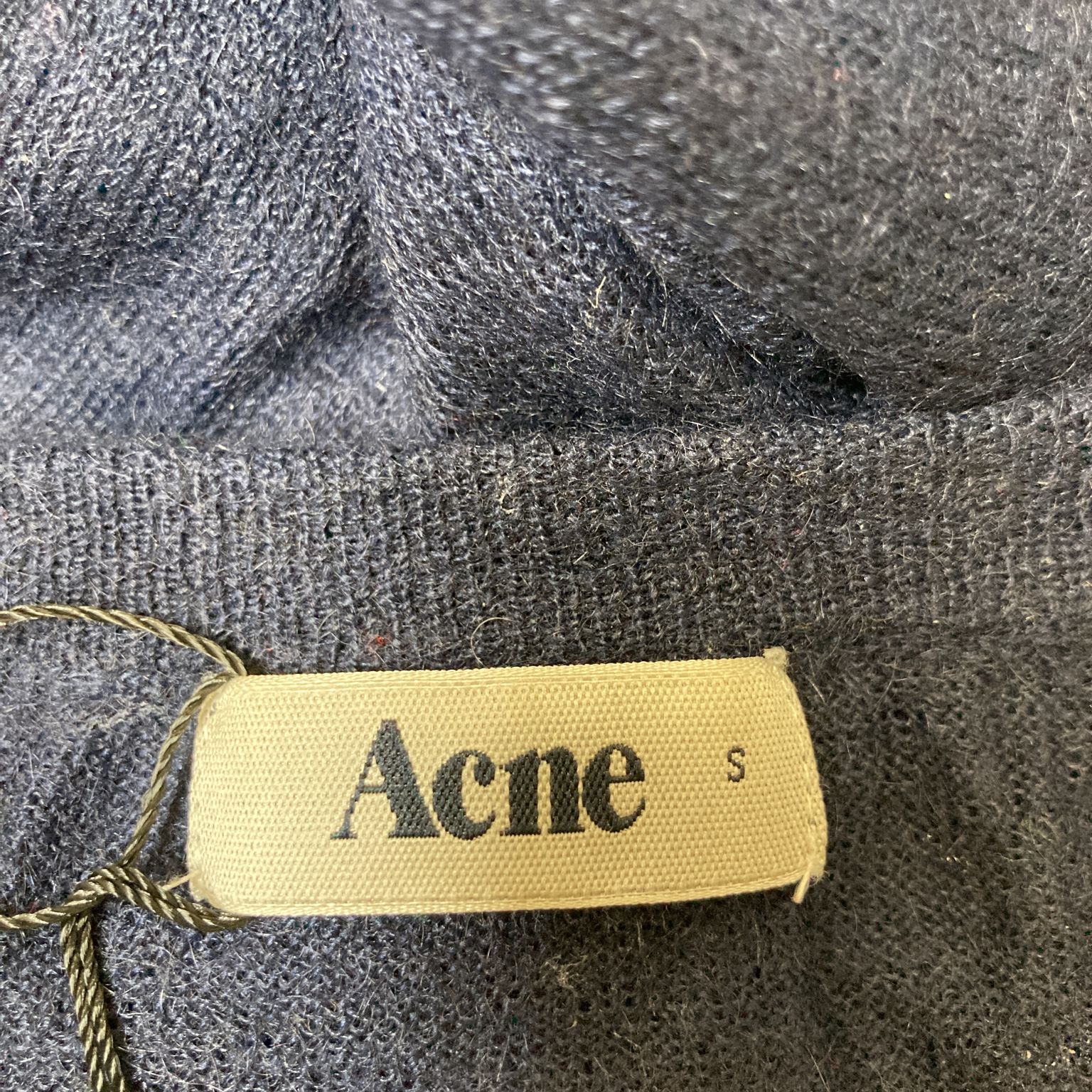 Acne