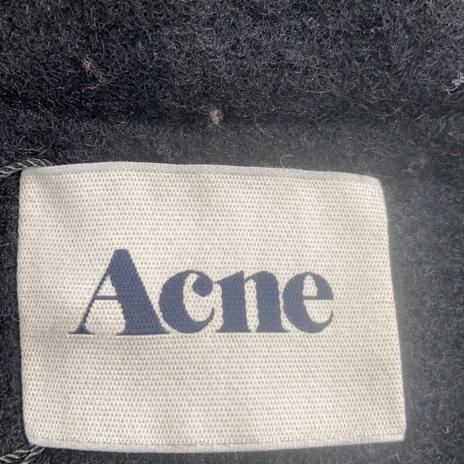 Acne