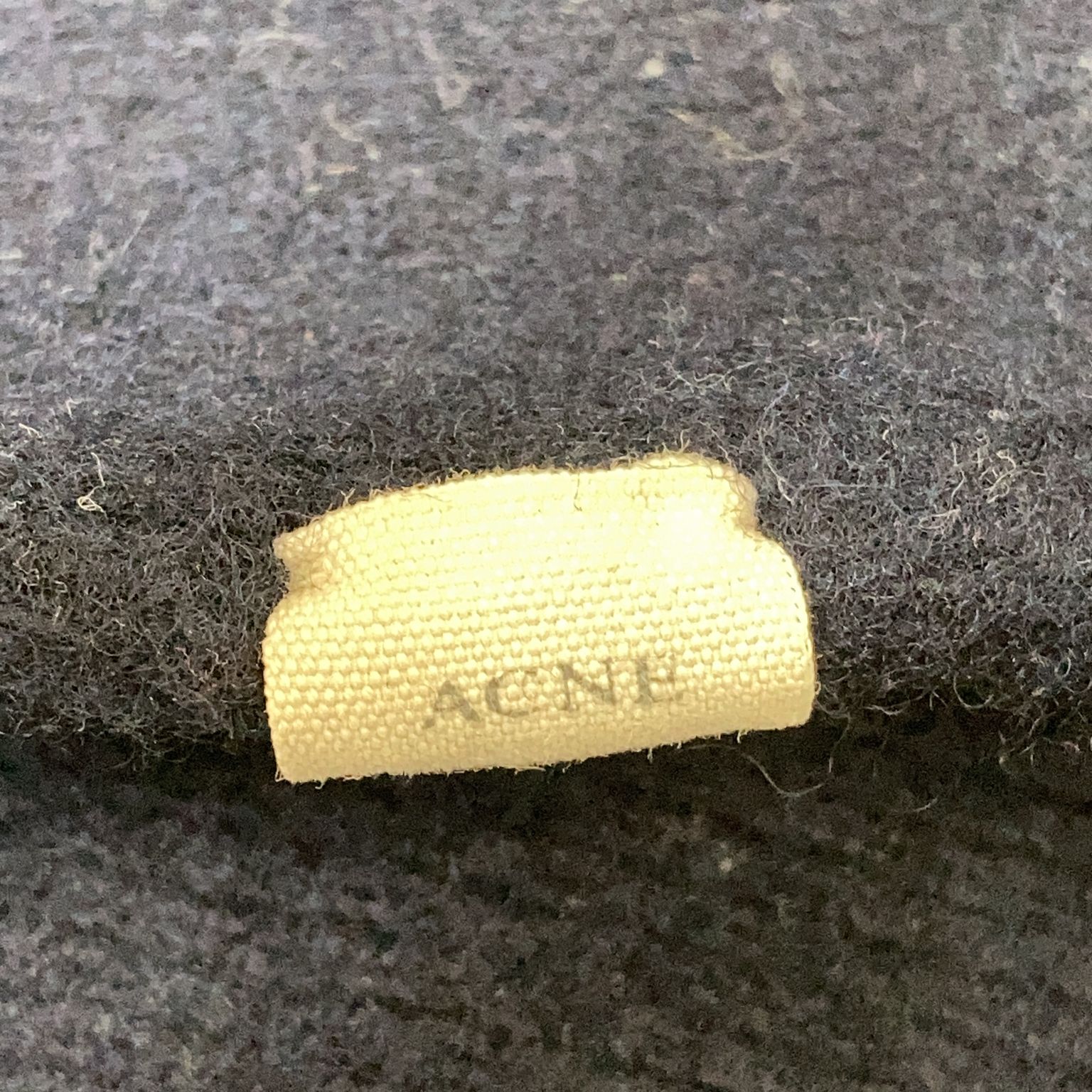 Acne