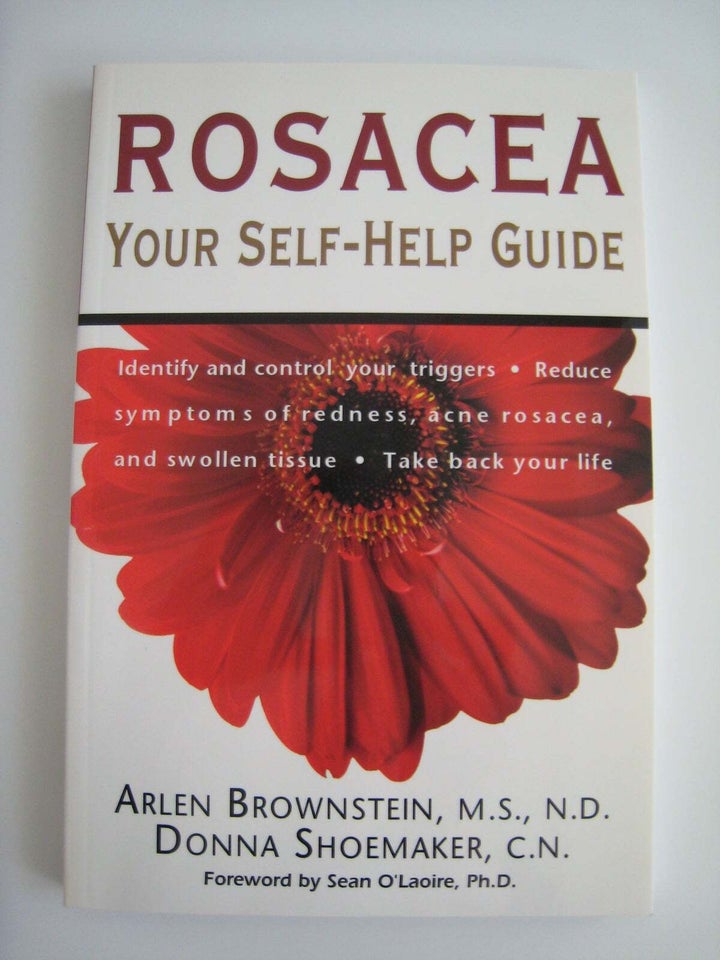 Rosacea your self-help guide,