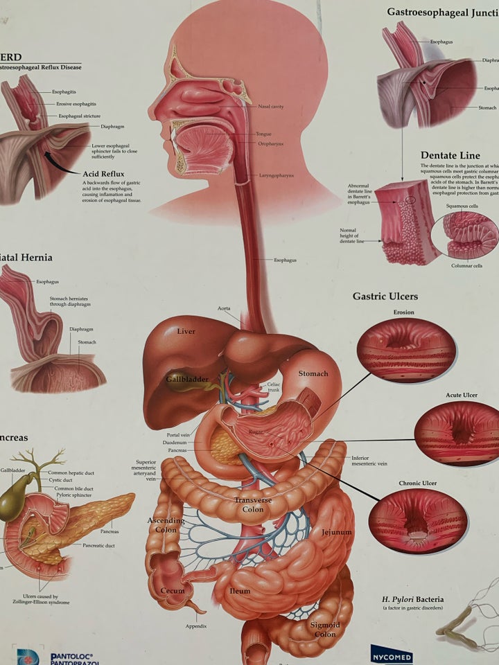 Plakat motiv: Gastroesophageal