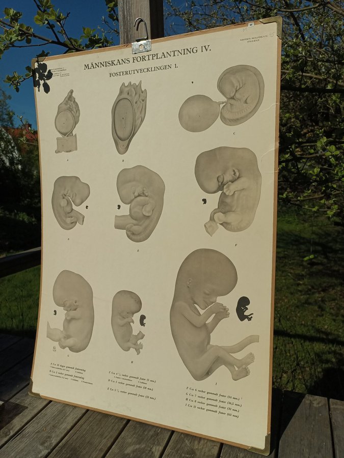 Skolplansch Människans Fortplantning Fosterutvecklingen 1 Norstedts Stockholm